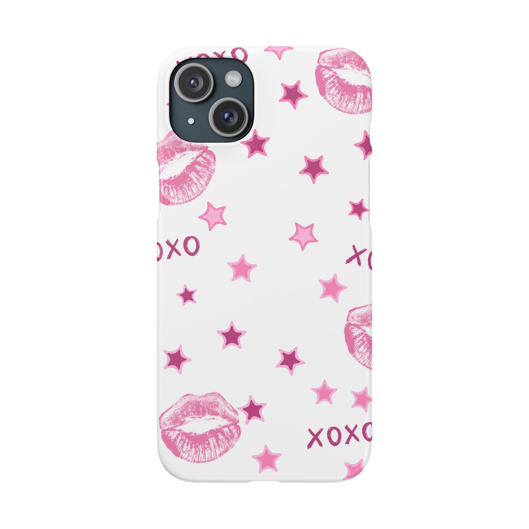 Kisses & Stars Snap Phone Case 💋