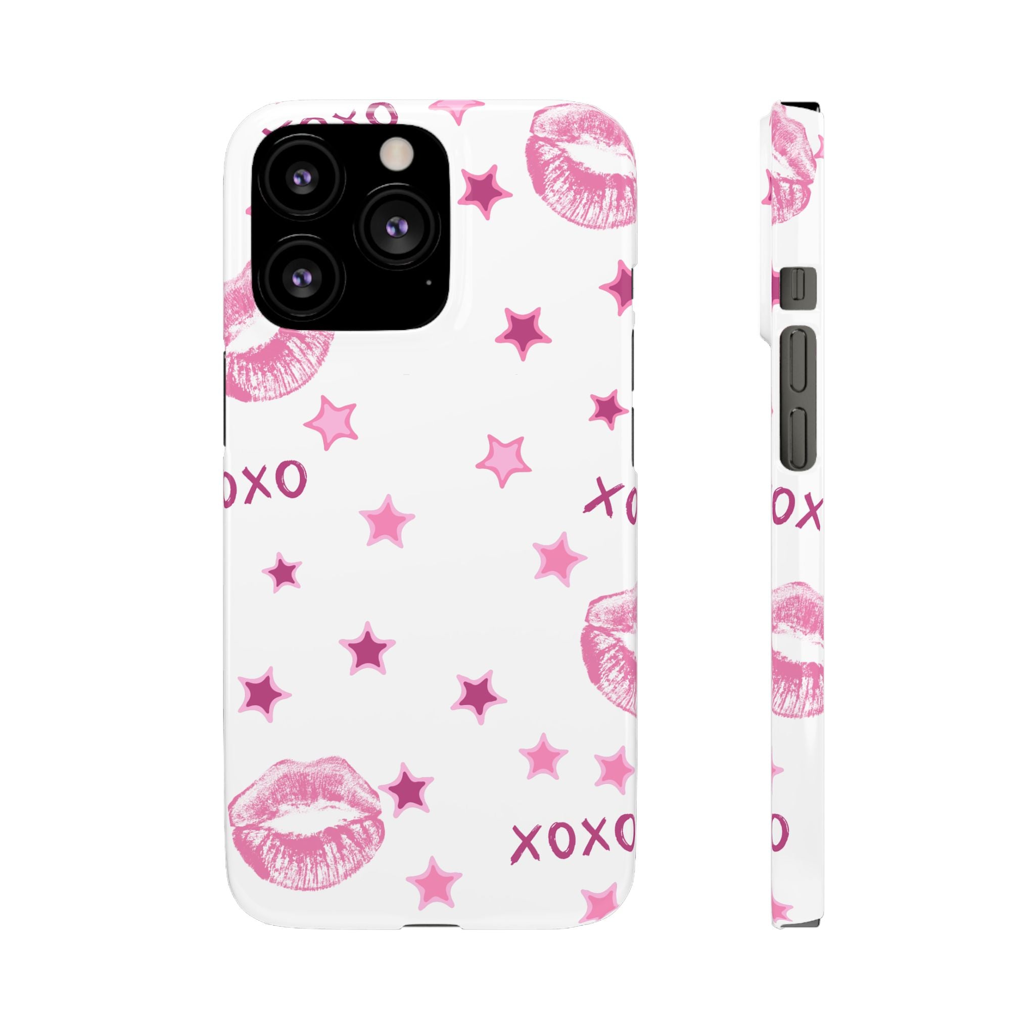 Kisses & Stars Snap Phone Case 💋