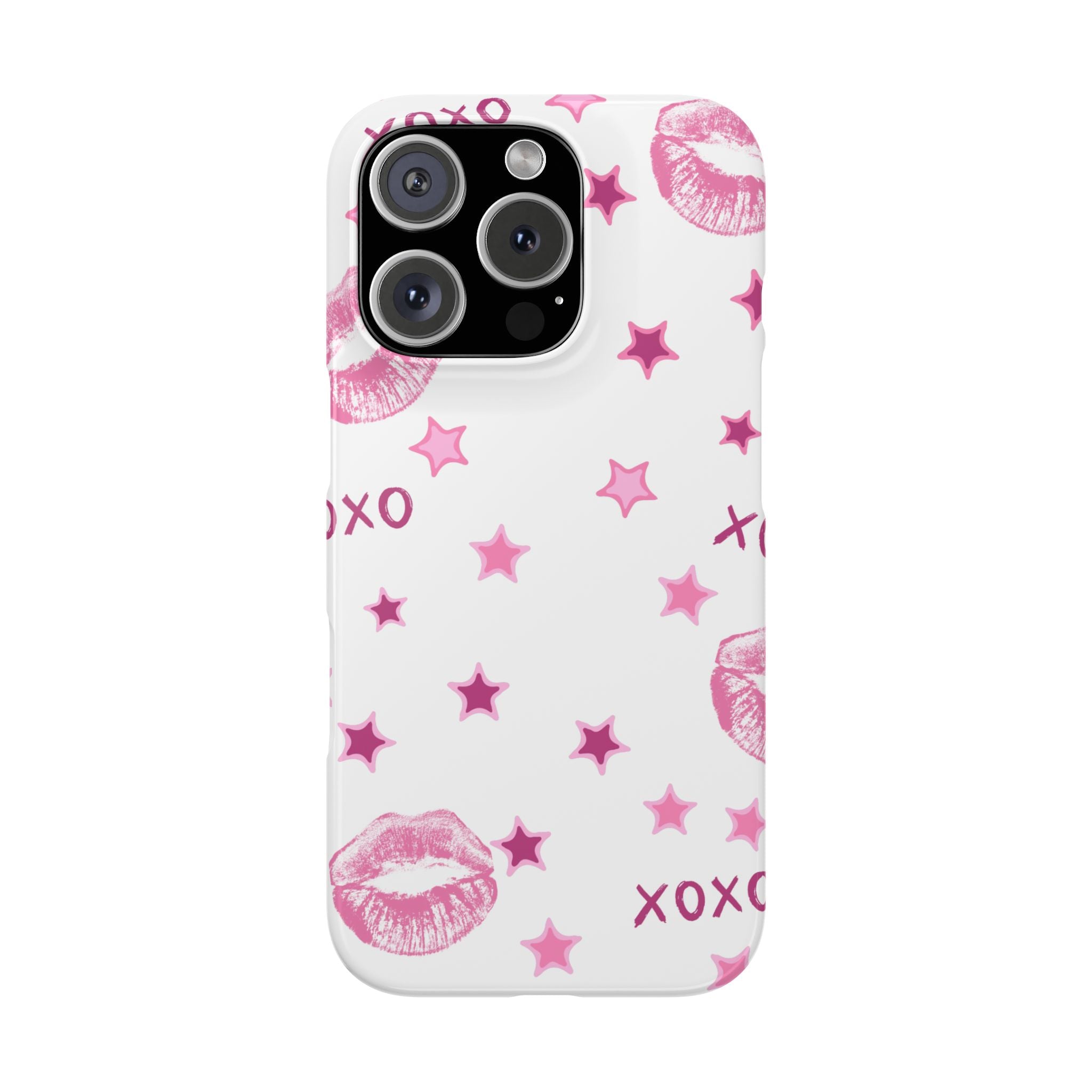 Kisses & Stars Snap Phone Case 💋