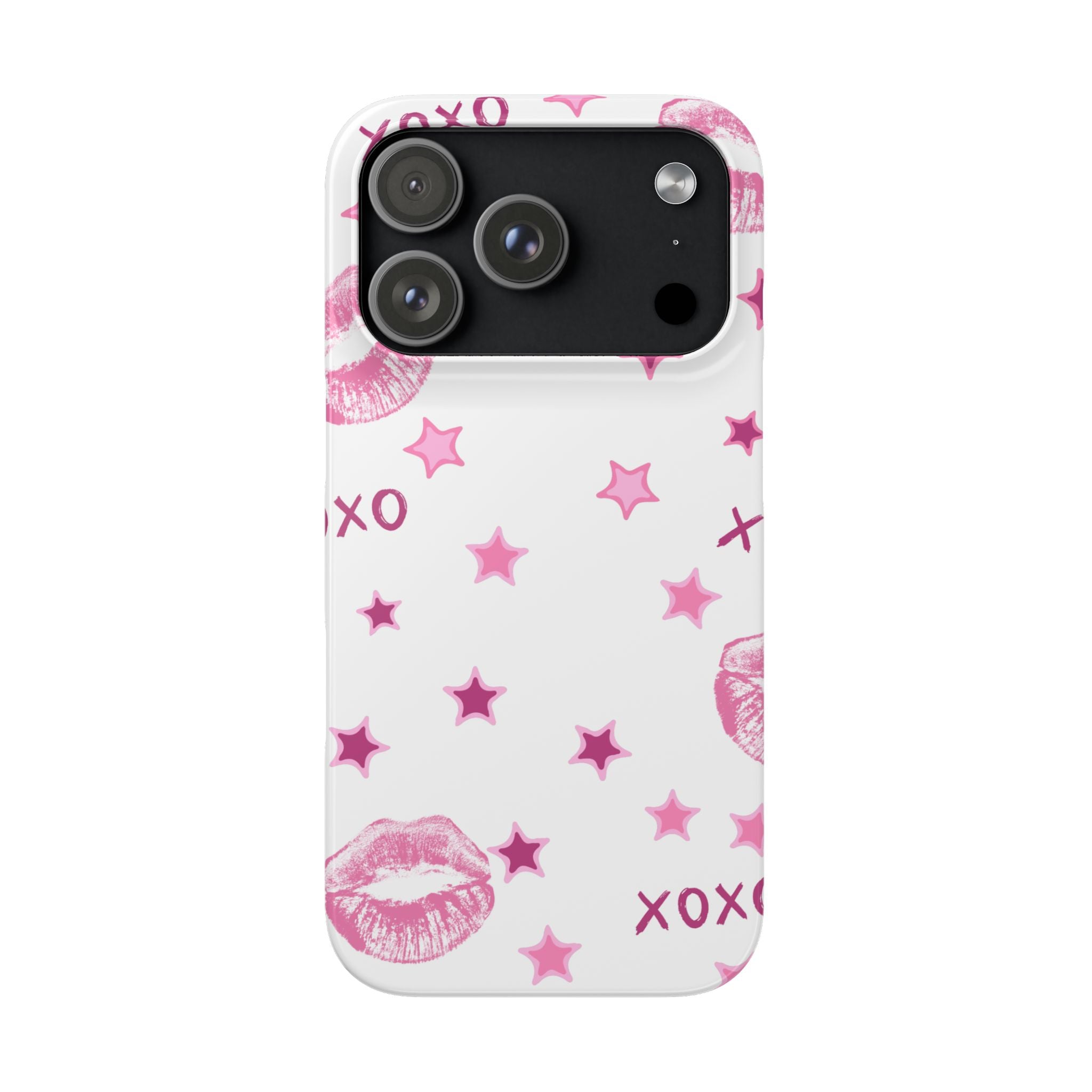 Kisses & Stars Snap Phone Case 💋
