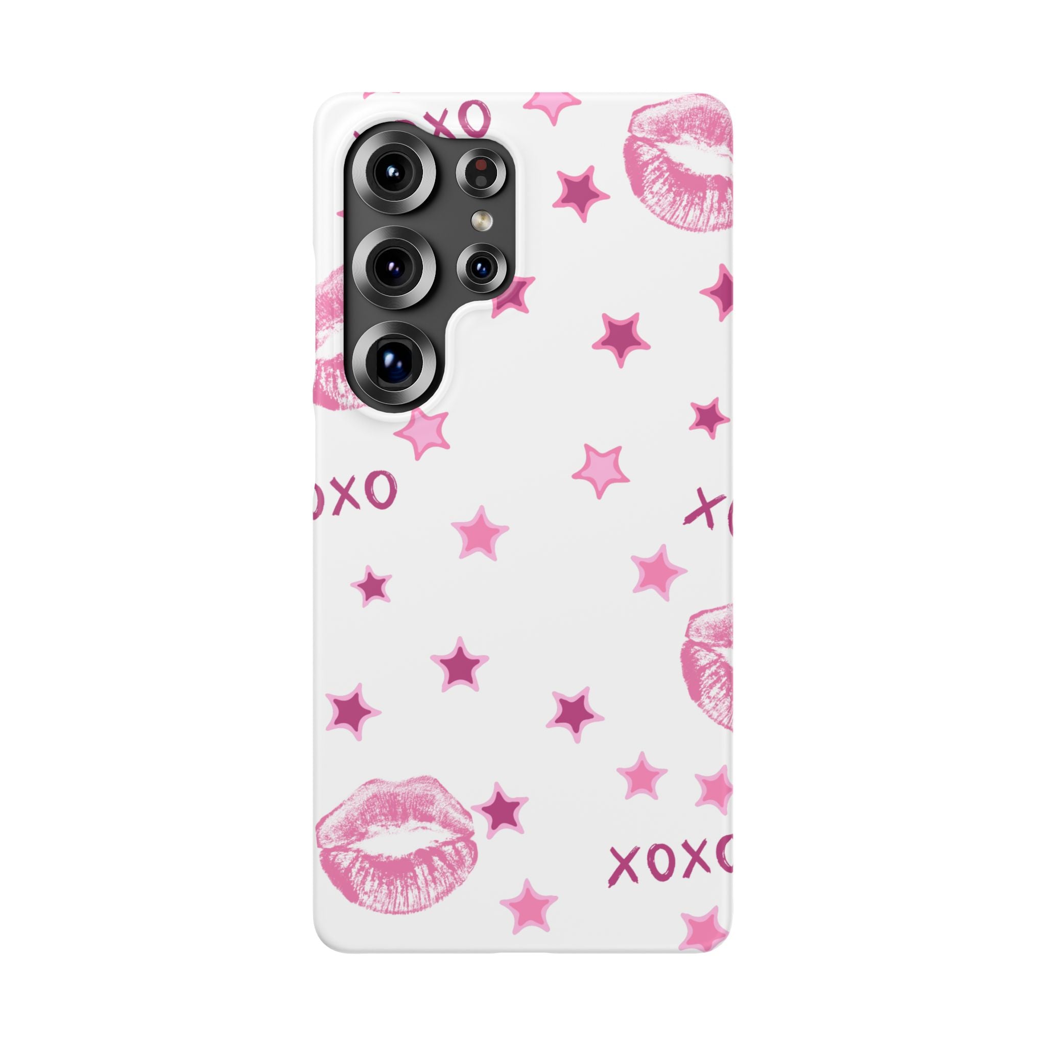 Kisses & Stars Snap Phone Case 💋