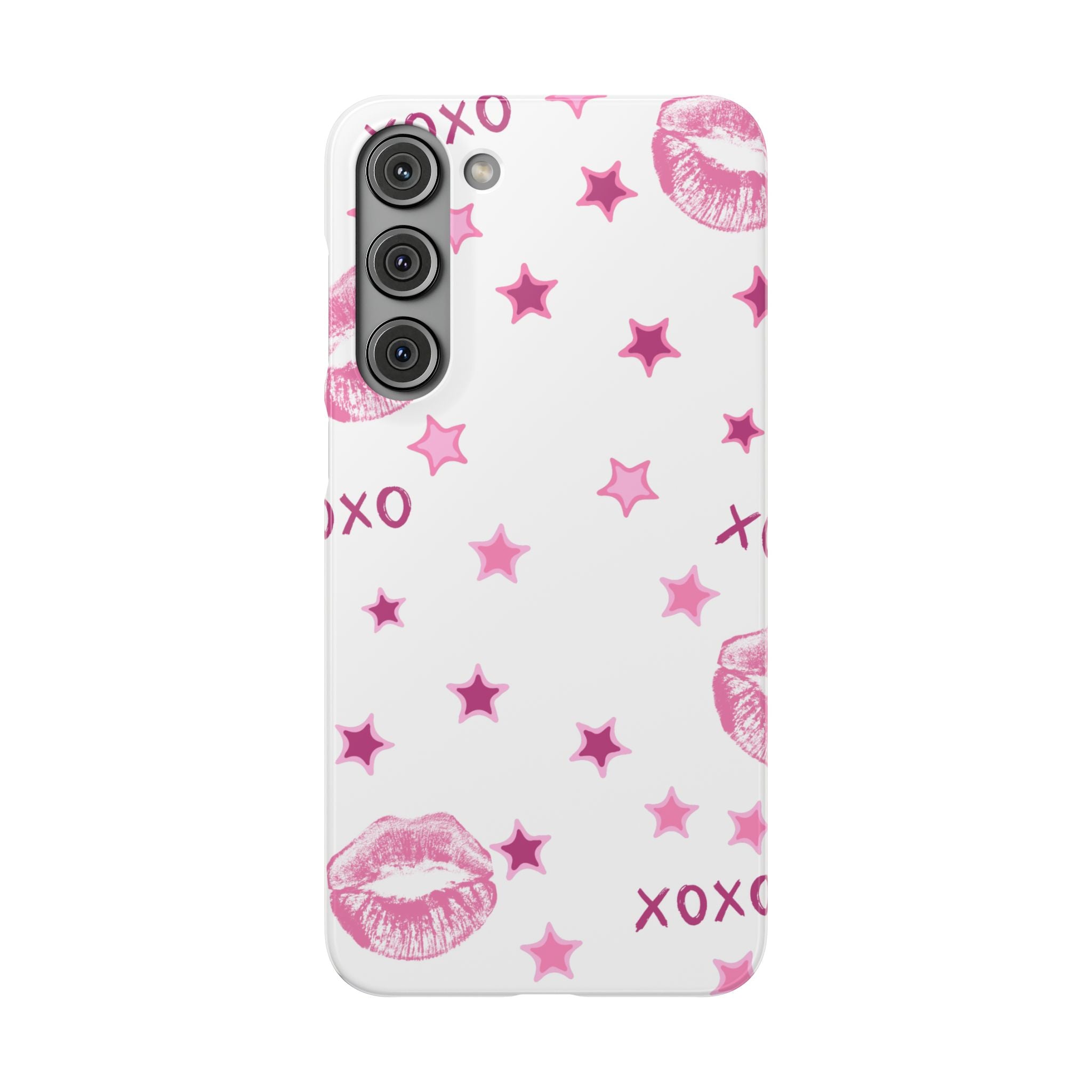 Kisses & Stars Snap Phone Case 💋