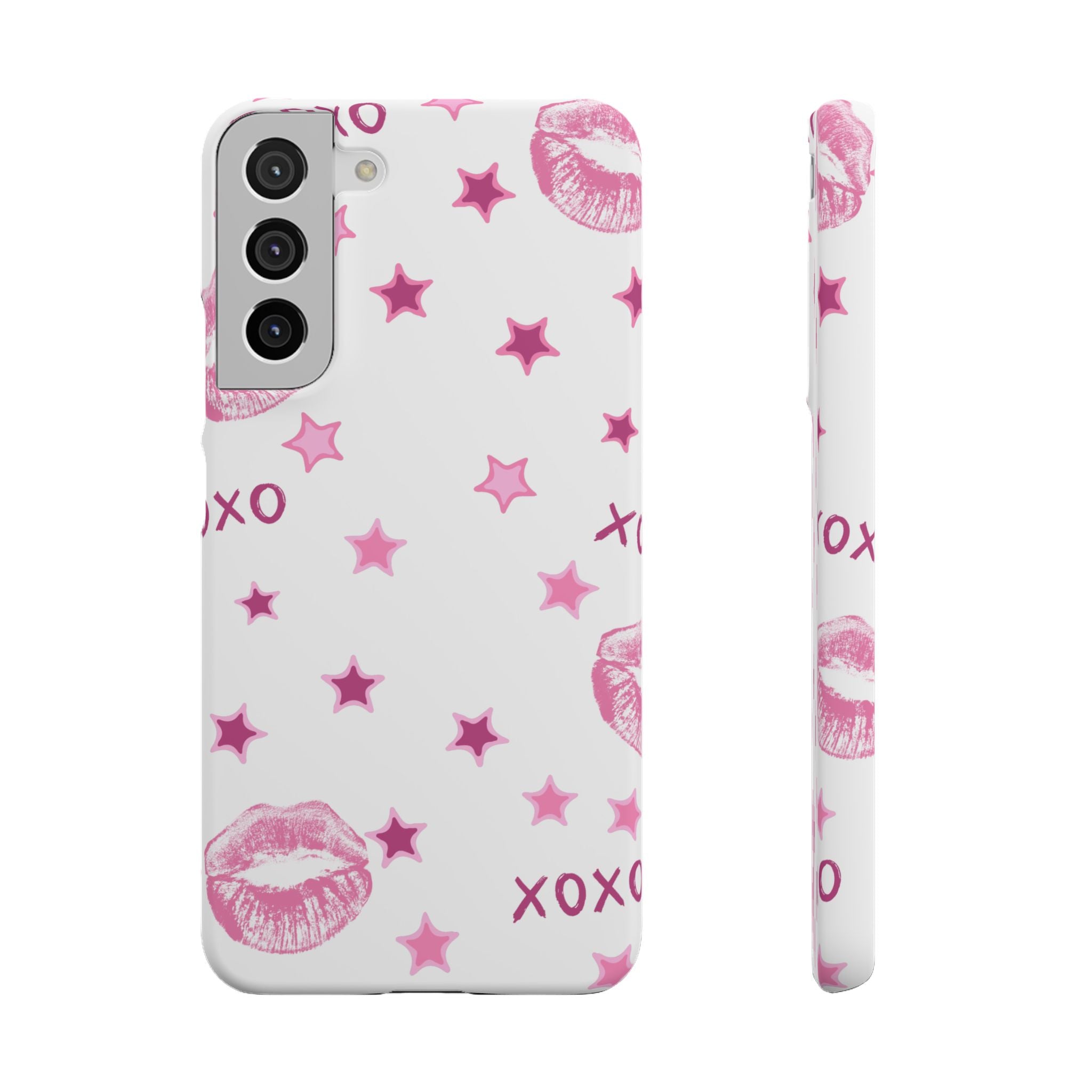 Kisses & Stars Snap Phone Case 💋