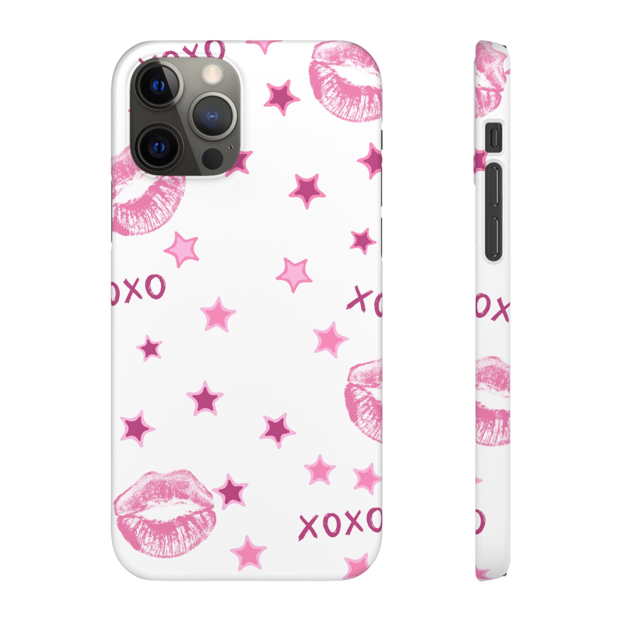Kisses & Stars Snap Phone Case 💋